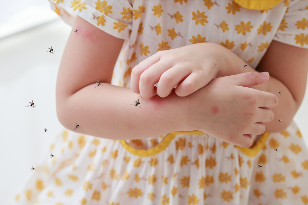 Mẹo Tránh Muỗi Đốt Cho Cả Trẻ Em Và Người Lớn chong muoi dot 1 1
